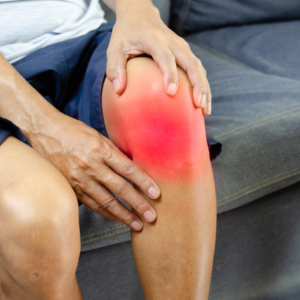 KNEE PAIN